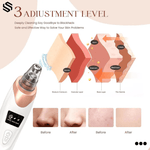 5-i-1 Blackhead Remover™ | Vakuum-hudormfjerner