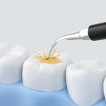 Ultra Smooth Electric Teeth Cleaner™ | Tannrensesett